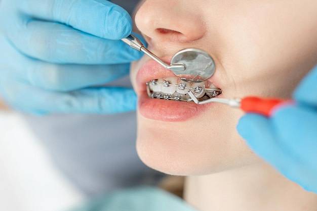 Lekarz ortodonta kontroluje prawidłowość leczenia zębów za pomocą aparatu ortodontycznego